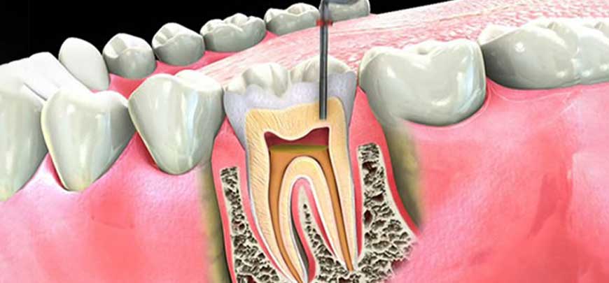 Endodontics