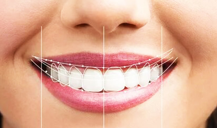 digital smile design paphos dentist